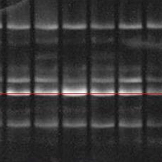 明膠酶譜MMP(2/9)檢測實(shí)驗(yàn)